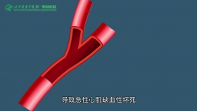 醫(yī)院胸痛中心動漫